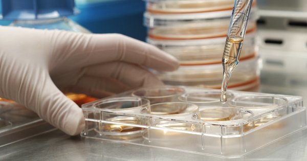 4 preguntas comunes sobre los laboratorios de células madres