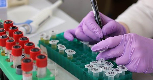 ¿Cuáles son los niveles de bioseguridad de un laboratorio?